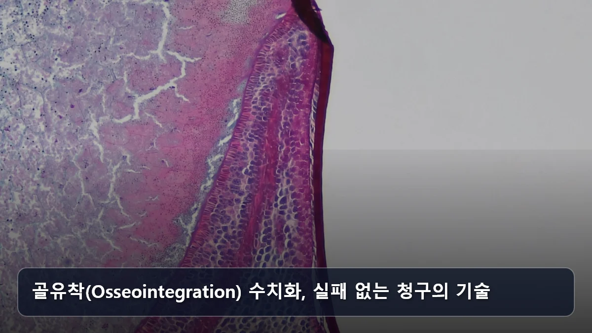 골유착(Osseointegration) 수치화, 실패 없는 청구의 기술 관련 이미지