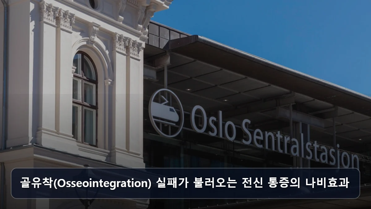 골유착(Osseointegration) 실패가 불러오는 전신 통증의 나비효과 관련 이미지